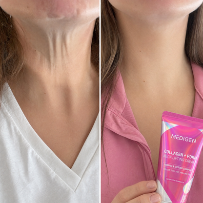 MediGen Collagen + PDRN Neck Lifting Cream