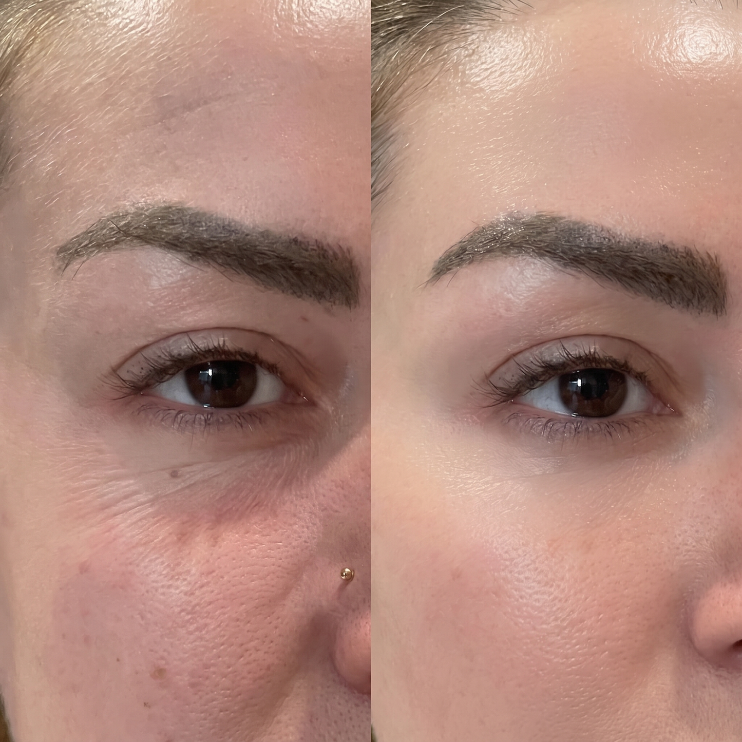 PDRN Volufiline Under Eye Firming Pen