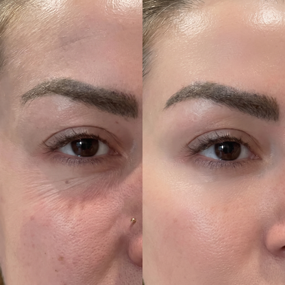 PDRN Volufiline Under Eye Firming Pen